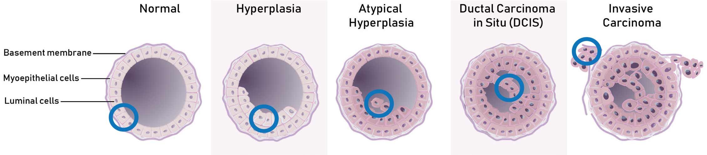 membrane.jpg